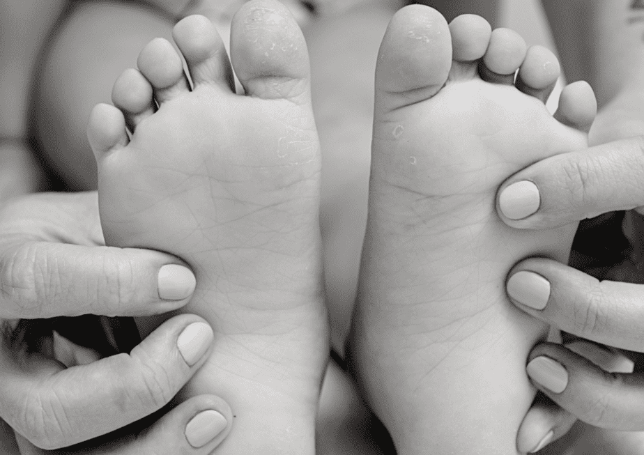 Child Foot Pain - Hypotonia