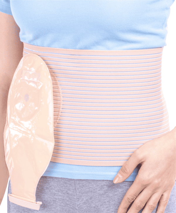 STOMATEX RING Abdominal Stoma Support SRT 136
